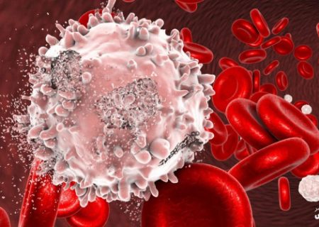 سرطان‌های شایع در ایران اعلام شدند